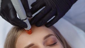 Hydrafacial Alicante