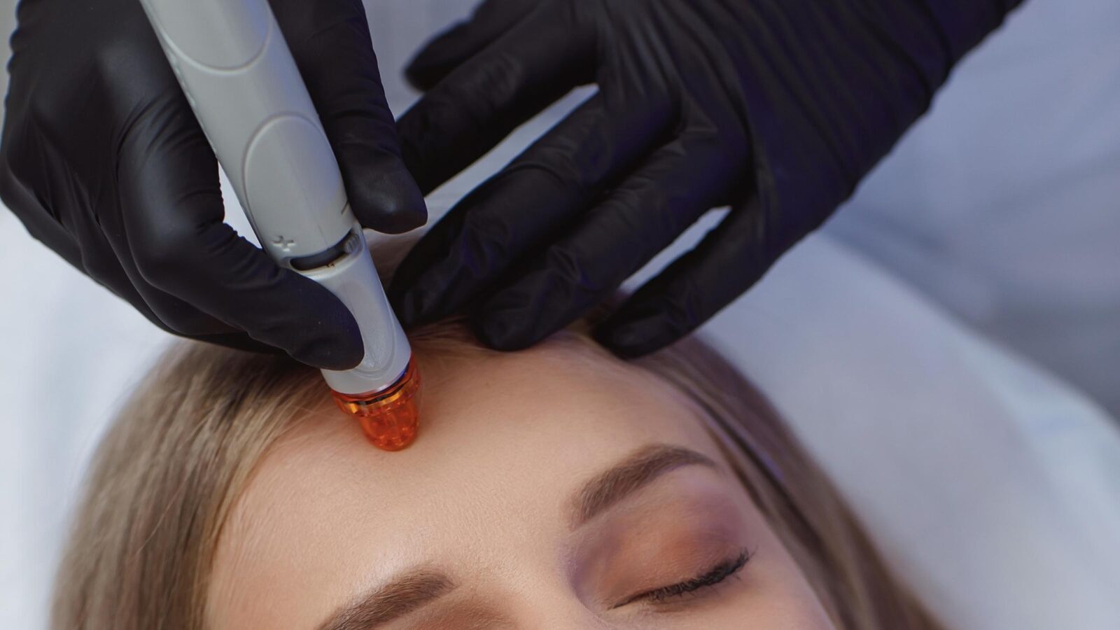 Hydrafacial Alicante